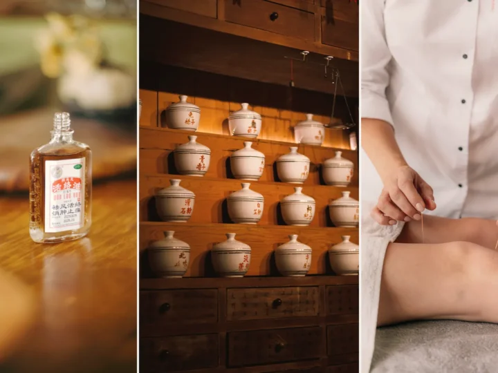 Best acupuncture in Perth